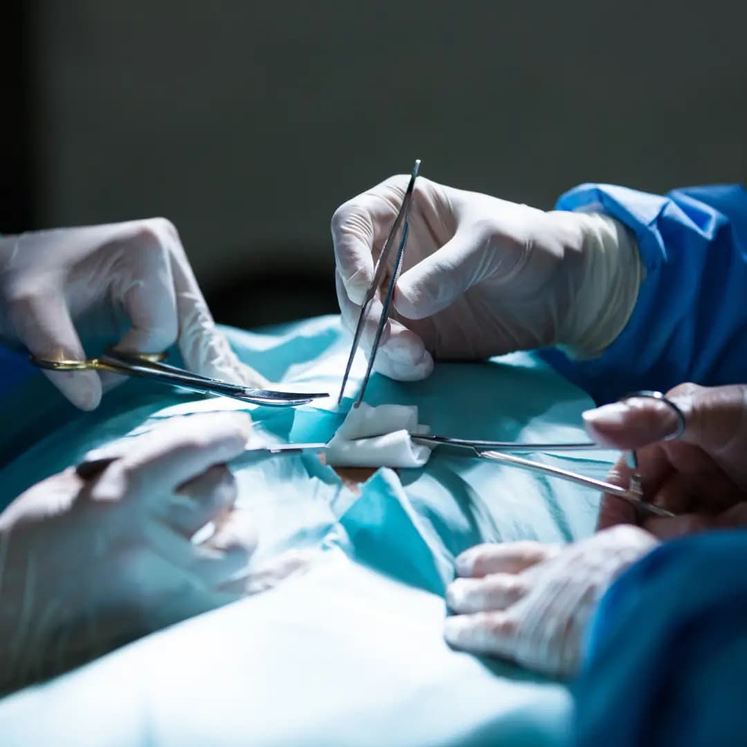Minimal Access Surgery